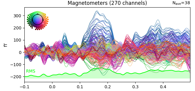 Magnetometers (270 channels)