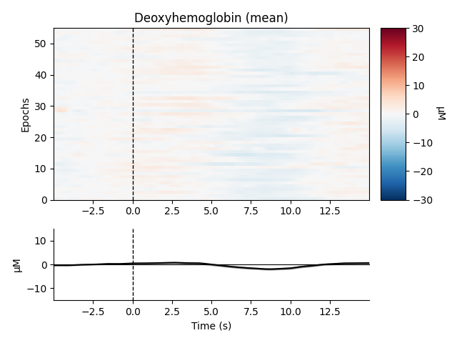 Deoxyhemoglobin (mean)