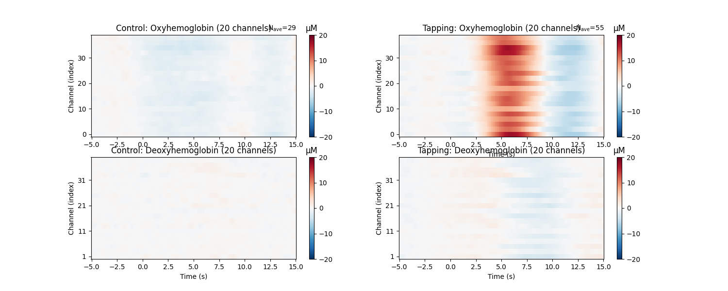 Control: Oxyhemoglobin (20 channels), Tapping: Oxyhemoglobin (20 channels), Control: Deoxyhemoglobin (20 channels), Tapping: Deoxyhemoglobin (20 channels), µM, µM, µM, µM