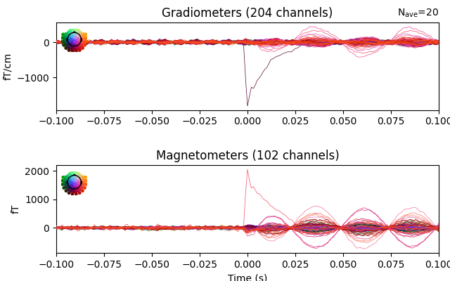 Gradiometers (204 channels), Magnetometers (102 channels)