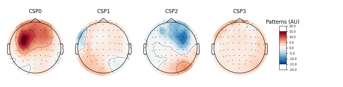 CSP0, CSP1, CSP2, CSP3, Patterns (AU)