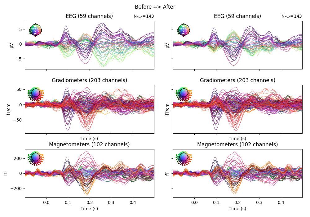 Before --> After, EEG (59 channels), EEG (59 channels), Gradiometers (203 channels), Gradiometers (203 channels), Magnetometers (102 channels), Magnetometers (102 channels)