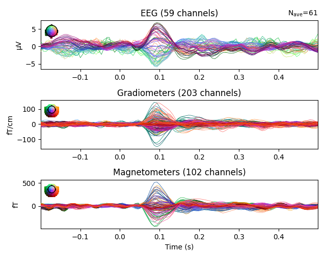 EEG (59 channels), Gradiometers (203 channels), Magnetometers (102 channels)