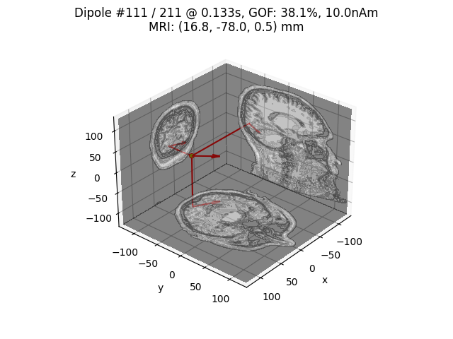 Dipole #111 / 211 @ 0.133s, GOF: 38.1%, 10.0nAm MRI: (16.8, -78.0, 0.5) mm