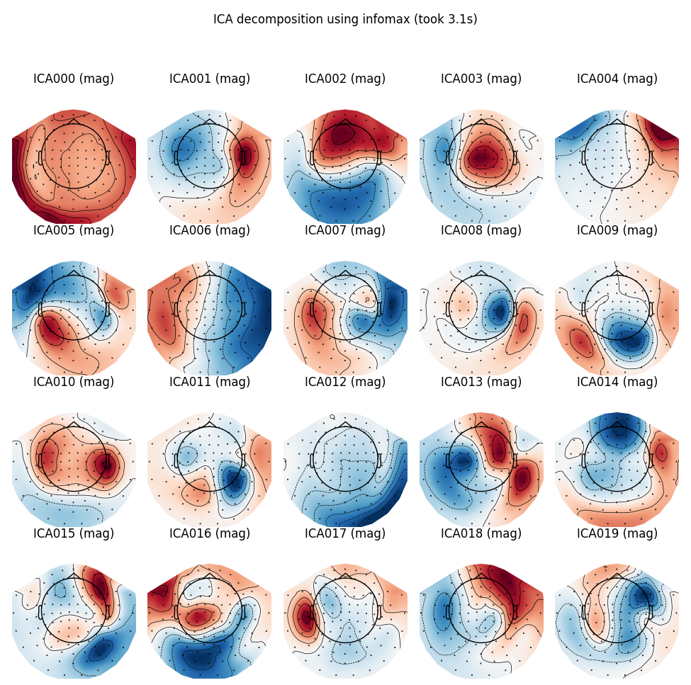 ICA decomposition using infomax (took 3.1s), ICA000 (mag), ICA001 (mag), ICA002 (mag), ICA003 (mag), ICA004 (mag), ICA005 (mag), ICA006 (mag), ICA007 (mag), ICA008 (mag), ICA009 (mag), ICA010 (mag), ICA011 (mag), ICA012 (mag), ICA013 (mag), ICA014 (mag), ICA015 (mag), ICA016 (mag), ICA017 (mag), ICA018 (mag), ICA019 (mag)