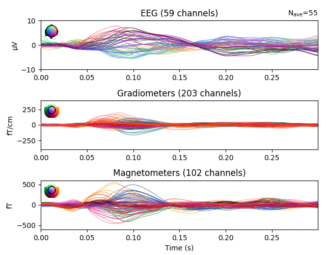 EEG (59 channels), Gradiometers (203 channels), Magnetometers (102 channels)