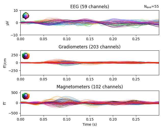 EEG (59 channels), Gradiometers (203 channels), Magnetometers (102 channels)