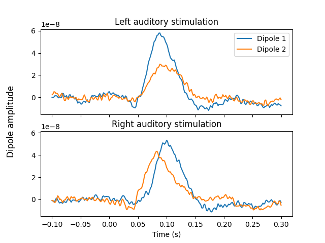 Left auditory stimulation, Right auditory stimulation