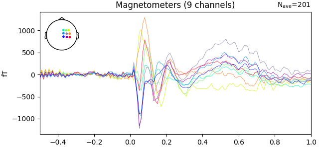 Magnetometers (9 channels)