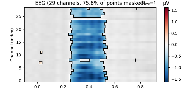 EEG (29 channels, 75.8% of points masked), µV