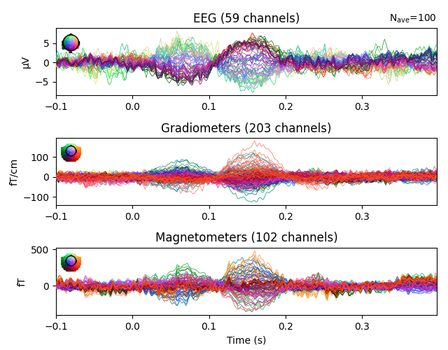 EEG (59 channels), Gradiometers (203 channels), Magnetometers (102 channels)