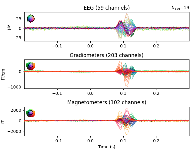 EEG (59 channels), Gradiometers (203 channels), Magnetometers (102 channels)