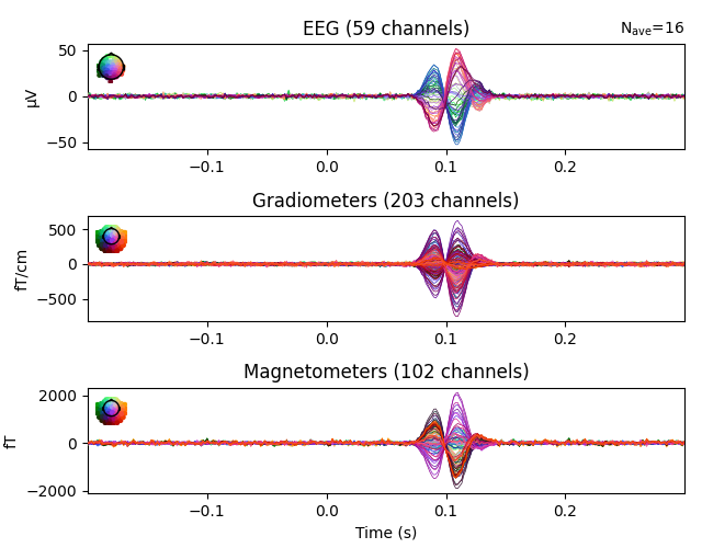 EEG (59 channels), Gradiometers (203 channels), Magnetometers (102 channels)