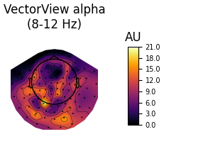 VectorView alpha (8-12 Hz), AU