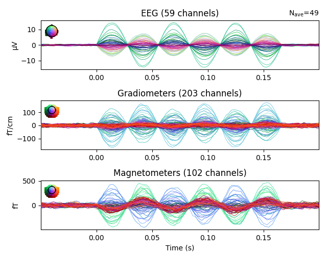 EEG (59 channels), Gradiometers (203 channels), Magnetometers (102 channels)