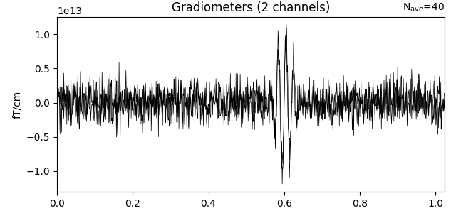 Gradiometers (2 channels)