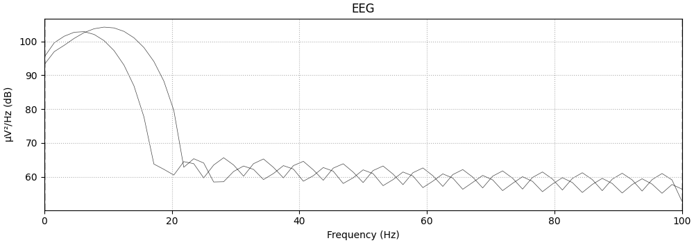 EEG