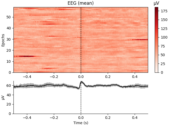 EEG (mean), µV