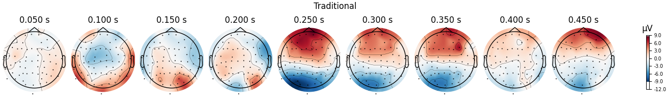 Traditional, 0.050 s, 0.100 s, 0.150 s, 0.200 s, 0.250 s, 0.300 s, 0.350 s, 0.400 s, 0.450 s, µV