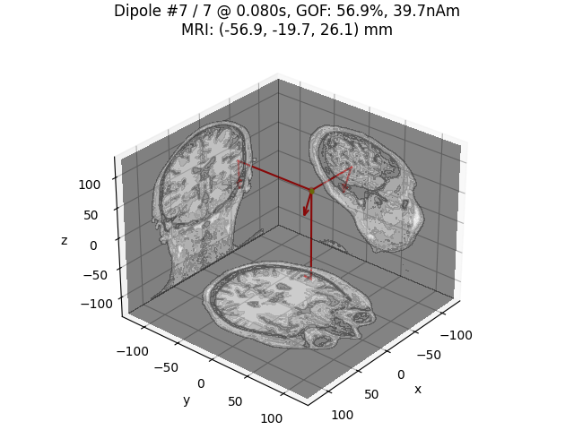 Dipole #7 / 7 @ 0.080s, GOF: 56.9%, 39.7nAm MRI: (-56.9, -19.7, 26.1) mm