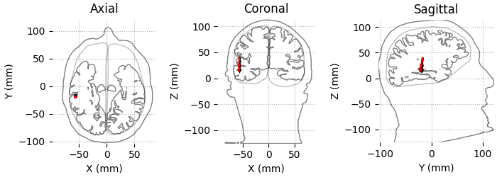 Axial, Coronal, Sagittal