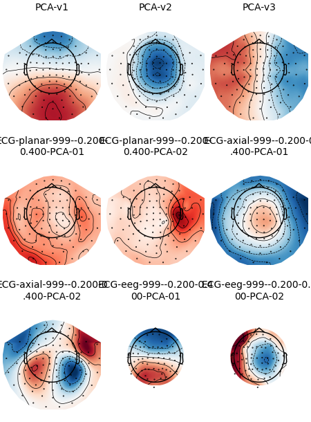 PCA-v1, PCA-v2, PCA-v3, ECG-planar-999--0.200- 0.400-PCA-01, ECG-planar-999--0.200- 0.400-PCA-02, ECG-axial-999--0.200-0 .400-PCA-01, ECG-axial-999--0.200-0 .400-PCA-02, ECG-eeg-999--0.200-0.4 00-PCA-01, ECG-eeg-999--0.200-0.4 00-PCA-02