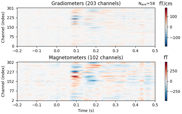 Gradiometers (203 channels), Magnetometers (102 channels), fT/cm, fT