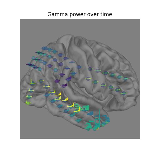 Gamma power over time