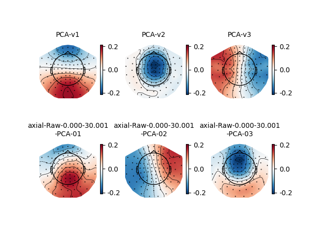 PCA-v1, PCA-v2, PCA-v3, axial-Raw-0.000-30.001 -PCA-01, axial-Raw-0.000-30.001 -PCA-02, axial-Raw-0.000-30.001 -PCA-03