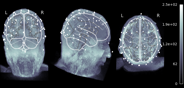 70 eeg mri coords