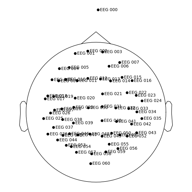 70 eeg mri coords