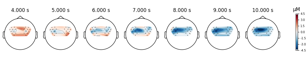 4.000 s, 5.000 s, 6.000 s, 7.000 s, 8.000 s, 9.000 s, 10.000 s, µM