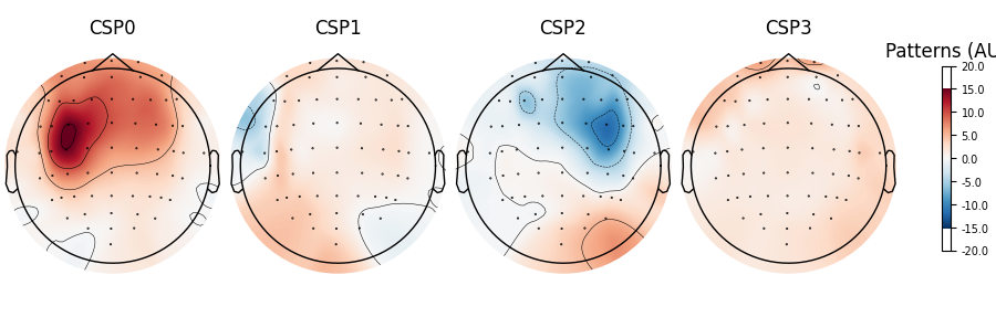 CSP0, CSP1, CSP2, CSP3, Patterns (AU)