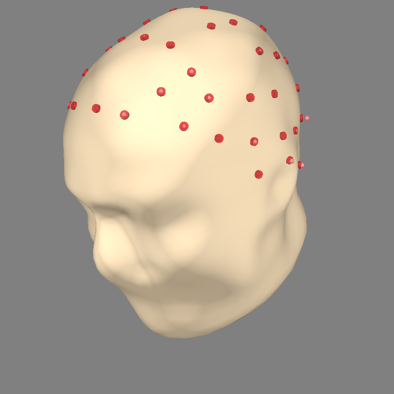 eeg on scalp