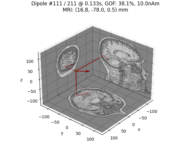 Dipole #111 / 211 @ 0.133s, GOF: 38.1%, 10.0nAm MRI: (16.8, -78.0, 0.5) mm