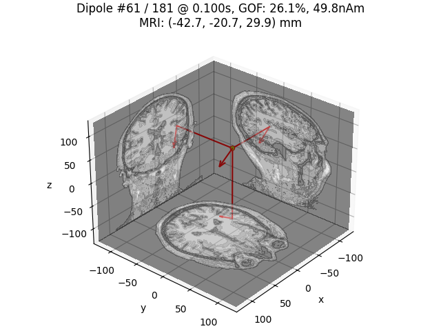 Dipole #61 / 181 @ 0.100s, GOF: 26.1%, 49.8nAm MRI: (-42.7, -20.7, 29.9) mm