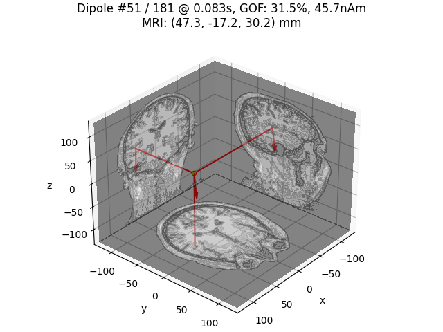 Dipole #51 / 181 @ 0.083s, GOF: 31.5%, 45.7nAm MRI: (47.3, -17.2, 30.2) mm