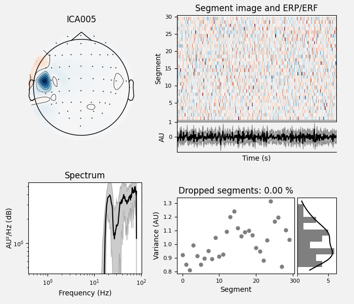 ICA005, Segment image and ERP/ERF, Spectrum, Dropped segments: 0.00 %