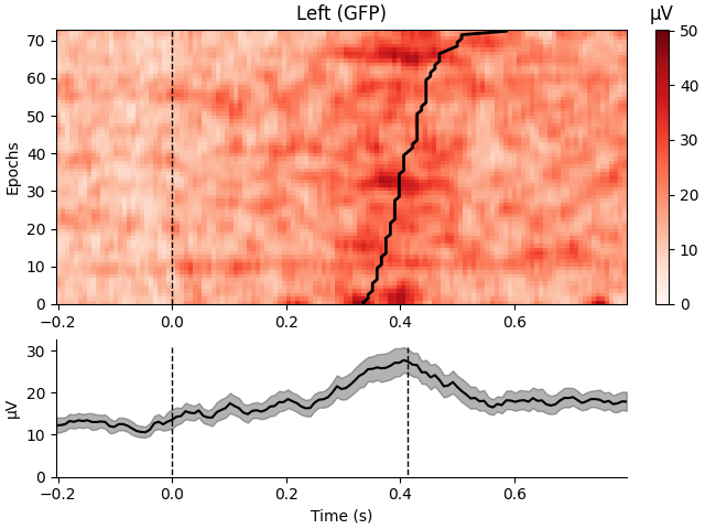 Left (GFP), µV