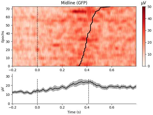 Midline (GFP), µV