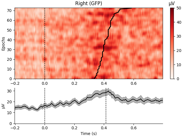 Right (GFP), µV