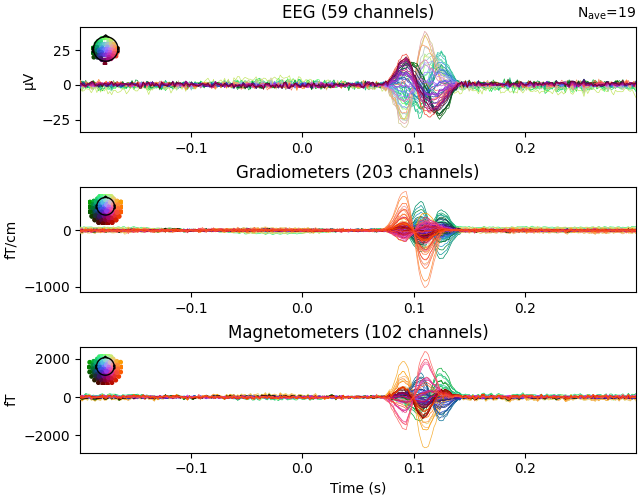 EEG (59 channels), Gradiometers (203 channels), Magnetometers (102 channels)