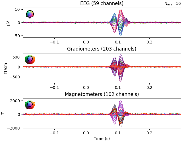 EEG (59 channels), Gradiometers (203 channels), Magnetometers (102 channels)