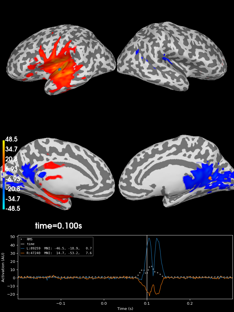 simulated raw data using subject anatomy