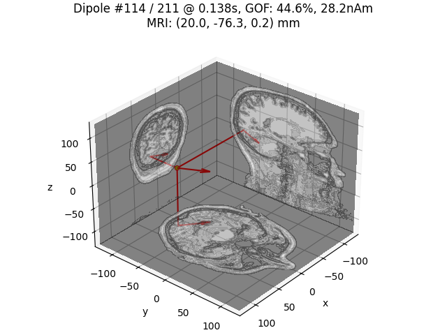 Dipole #114 / 211 @ 0.138s, GOF: 44.6%, 28.2nAm MRI: (20.0, -76.3, 0.2) mm