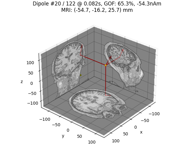 Dipole #20 / 122 @ 0.082s, GOF: 65.3%, -54.3nAm MRI: (-54.7, -16.2, 25.7) mm