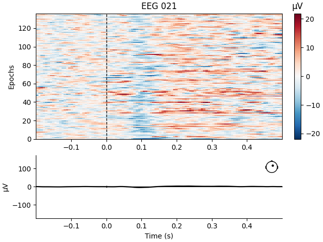 EEG 021, µV