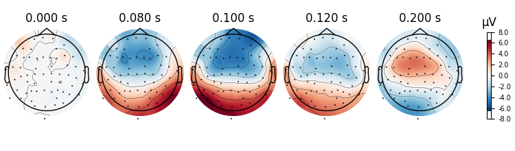 0.000 s, 0.080 s, 0.100 s, 0.120 s, 0.200 s, µV