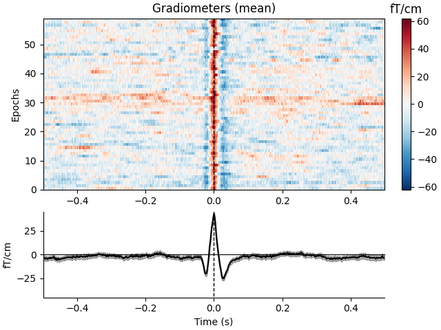 Gradiometers (mean), fT/cm