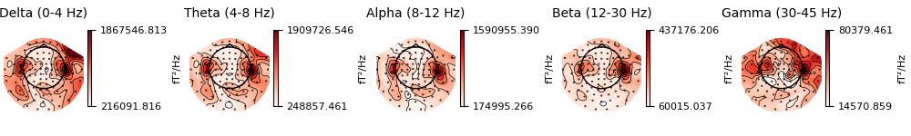 Delta (0-4 Hz), Theta (4-8 Hz), Alpha (8-12 Hz), Beta (12-30 Hz), Gamma (30-45 Hz)